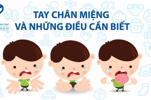 Khuyến cáo phòng chống dịch Tay Chân Miệng